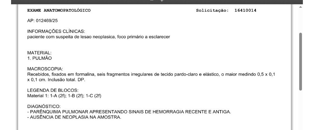 Laudo da biópsia endobrônquica mostrando ausência de neoplasia