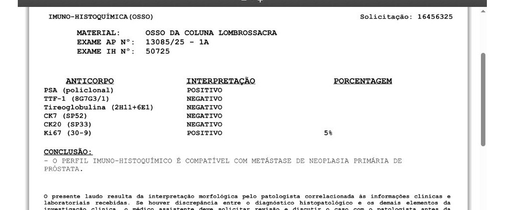 Laudo de IHQ confirmando metástase de neoplasia primária de próstata